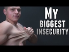 My Biggest Insecurity: Loose Skin