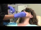 Hair Removal In Rockford IL | Best Hair Removal In Rockford IL
