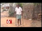 Health News on Kidney Stones, Fluorosis- Remedy Hospital in Hyderabad - 6TV Sanjeevani