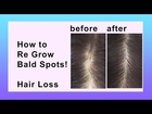 Hair Loss Natural Home Remedy