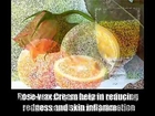 Best Rosacea Skin Care Tips